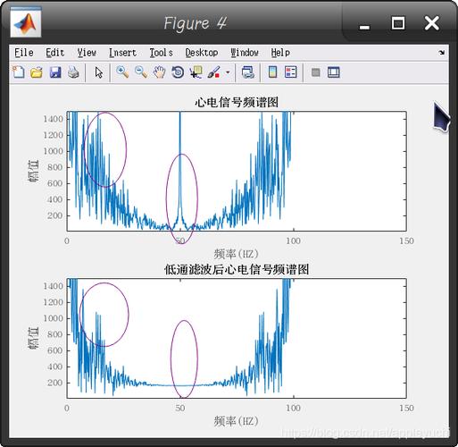 基于匹配追踪和最大重叠离散小波的ECG心电信号R波检测（MATLAB）(信号心电噪声离散重叠) 排名链接