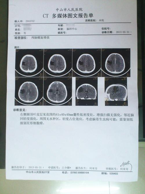 古今今因脑瘤遗憾退役(脑瘤古今国少队退役球员) 排名链接