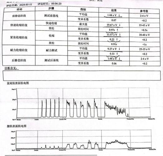 中国肌电图电极市场报告、及市场预测(电极肌电图销量增长率市场) 软件开发