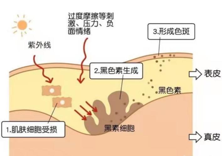 肤色不均、暗沉的原因及亮肤方法(皮肤肤色黑色素美白原因) 排名链接