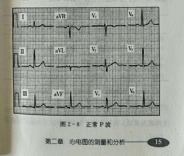 【避坑指南】S9KEAZ64的PTB4无法正常输出波形(功能波形断电复位无法正常) 排名链接