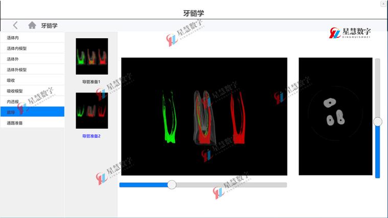 牙齿VR实训软件：引领数字化口腔教学(实训牙齿咬合软件口腔) 软件优化