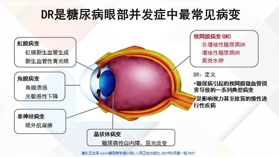 IT从业者们职业病防治指南(业者眼部导致可能会视网膜) 排名链接