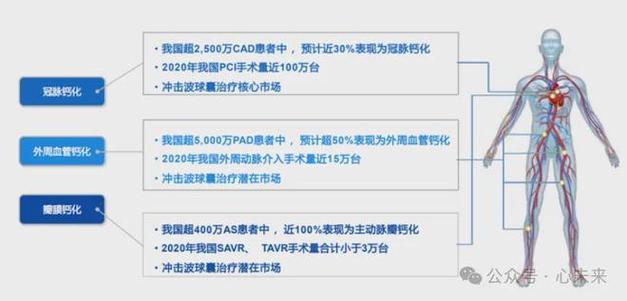 2024全球冲击波治疗系统市场前景预测行业报告-路亿市场策略(冲击波治疗系统销量收入) 软件开发